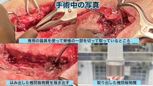 椎間板ヘルニアの手術の様子