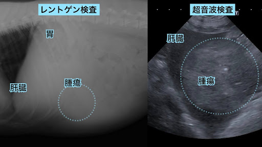 腫瘍の画像検査画像