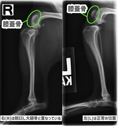 膝蓋骨が脱臼しているレントゲン画像