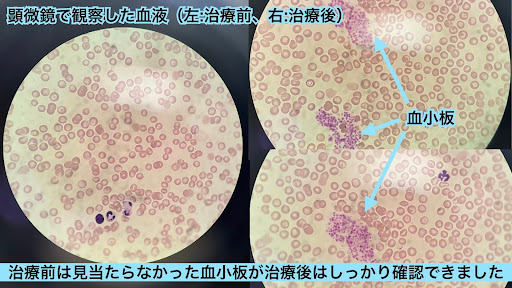 顕微鏡での血小板の画像