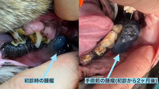 初診時と手術前の主流の様子