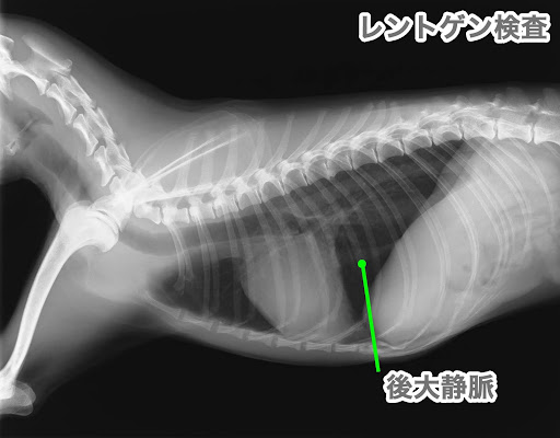 アジソン病のレントゲン画像