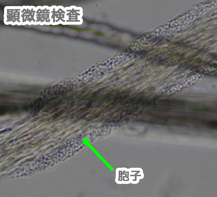 猫の皮膚糸状菌症の一例